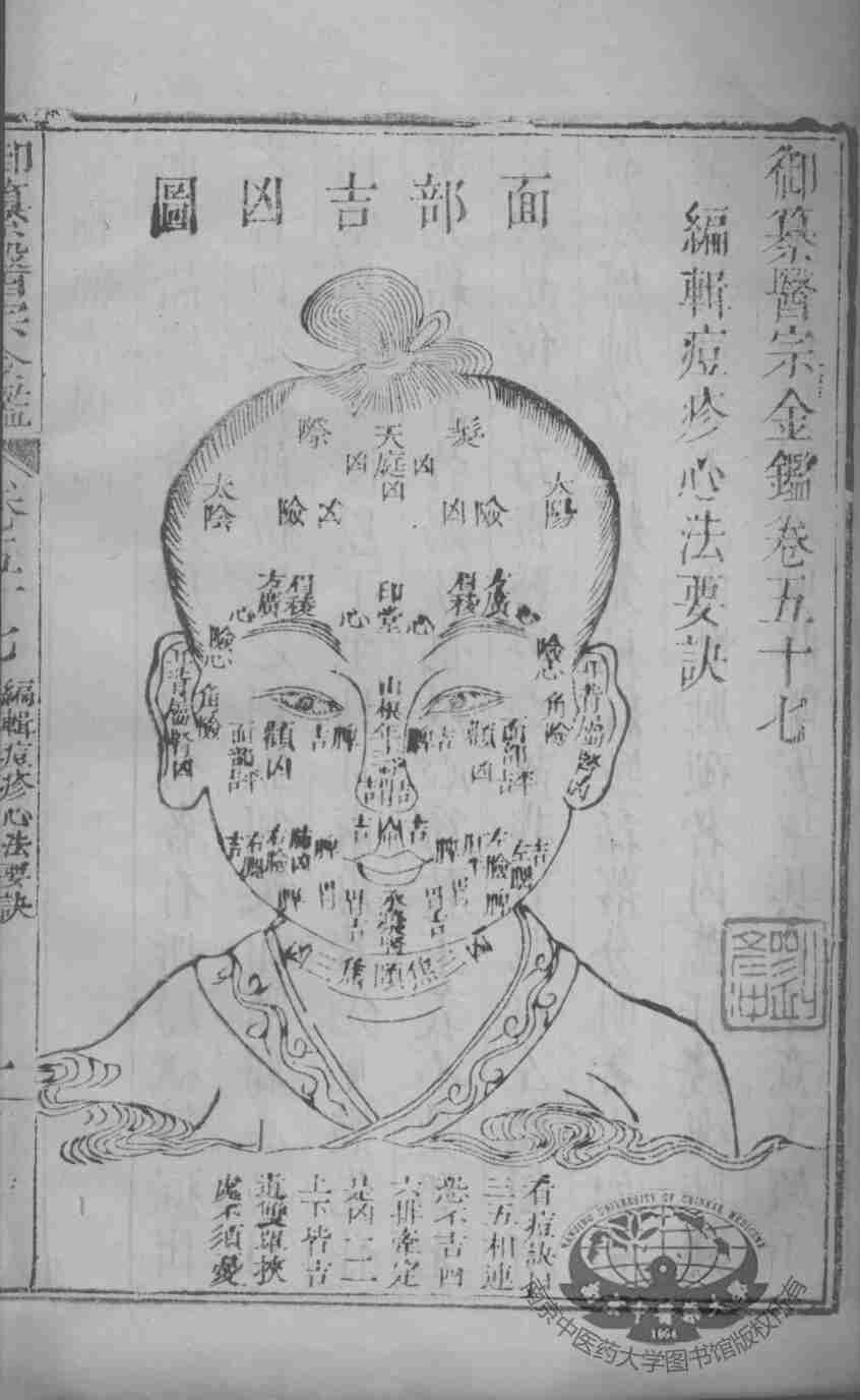 医宗金鉴  卷57